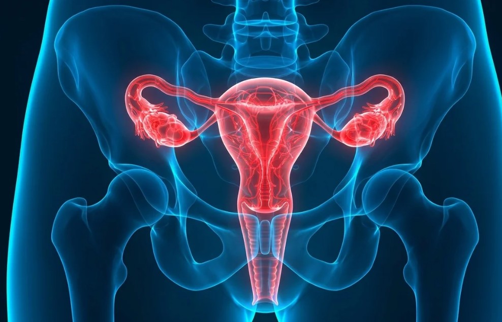 ¿Qué es la endometriosis y cómo puede afectar la fertilidad de las mujeres?